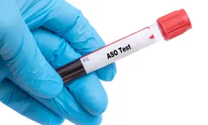 Rękawiczka w kolorze niebieskim trzyma probówkę z oznaczeniem "ASO Test".