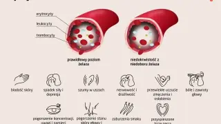 Porównanie prawidłowego poziomu żelaza z niedoborem. Niedobór żelaza prowadzi do anemii, objawiającej się m.in. bladością skóry, zmęczeniem i bólami głowy.
