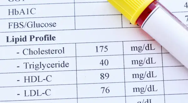 Wynik lipidogramu: cholesterol 175 mg/dL, HDL 89 mg/dL, LDL 76 mg/dL. Sprawdź, czy cholesterol nie HDL norma jest zachowana.