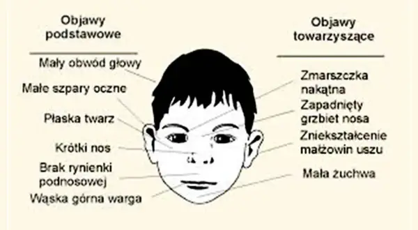FAS: Rozpoznaj ukryte objawy. Wczesna diagnoza ratuje przyszłość