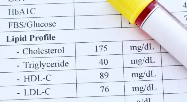 Wynik lipidogramu: cholesterol całkowity 175, trójglicerydy 40, HDL 89, LDL-C 76. Wynik ten pokazuje, że cholesterol nie HDL jest w normie.