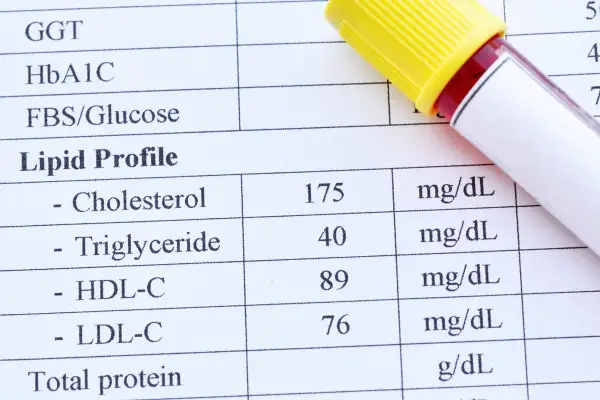 Wynik lipidogramu: cholesterol 175 mg/dL, HDL 89 mg/dL, LDL 76 mg/dL. Sprawdź, czy cholesterol nie HDL norma jest zachowana.