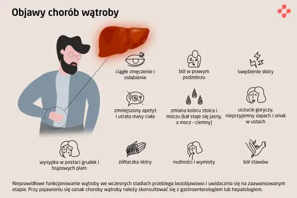 Ilustracja przedstawia objawy chorób wątroby, w tym zmęczenie, ból brzucha, swędzenie skóry, nudności, żółtaczkę, a także zmiany w kolorze moczu i stolca. Wzw c może objawiać się podobnymi symptomami.