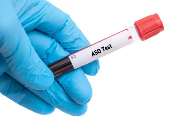 Rękawiczka w kolorze niebieskim trzyma probówkę z oznaczeniem "ASO Test".