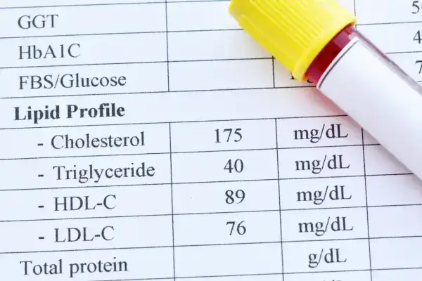 Wynik lipidogramu: cholesterol całkowity 175, trójglicerydy 40, HDL 89, LDL-C 76. Wynik ten pokazuje, że cholesterol nie HDL jest w normie.