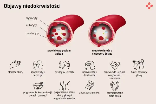 Porównanie prawidłowego poziomu żelaza z niedoborem. Niedobór żelaza prowadzi do anemii, objawiającej się m.in. bladością skóry, zmęczeniem i bólami głowy.