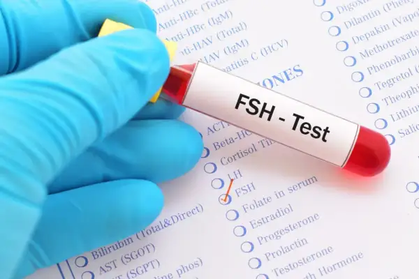 Ręka w niebieskiej rękawiczce trzyma probówkę z napisem "FSH - Test". Obok zaznaczono opcję FSH na liście badań.